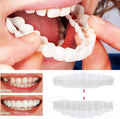 Acrylic Resin Smile Veneers for Upper and Lower Jaw with Moulds, view 2