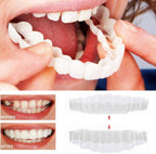 Acrylic Resin Smile Veneers for Upper and Lower Jaw with Moulds, view 2