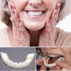 Acrylic Resin Smile Veneers for Upper and Lower Jaw with Moulds