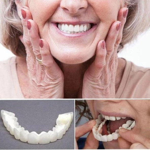 Acrylic Resin Smile Veneers for Upper and Lower Jaw with Moulds
