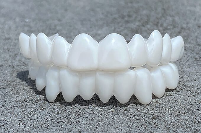 Dental Veneers Made from Resin, Reusable Fit-Over Design, view 2