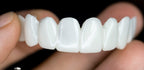 Dental Veneers Made from Resin, Reusable Fit-Over Design, view 4