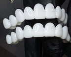 DentAlign Resin Dental Veneers, Reusable and Easy to Apply and Remove, view 5