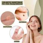 DermaLinx Wart Remover for Home Use for Face, Neck, Hands and Feet, view 2