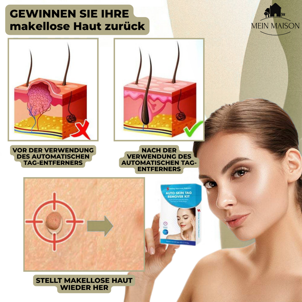DermaLinx Wart Remover for Home Use for Face, Neck, Hands and Feet, view 5