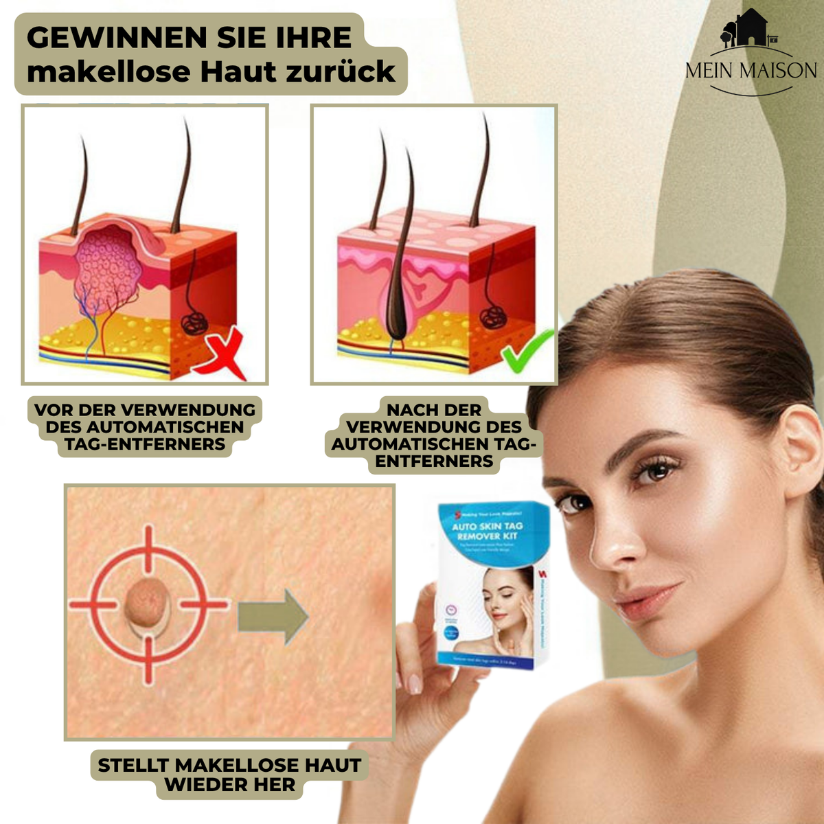DermaLinx Wart Remover for Home Use for Face, Neck, Hands and Feet, view 5
