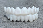 Reusable Dental Prosthesis with White Veneers in Resin for Everyday Wear, view 3