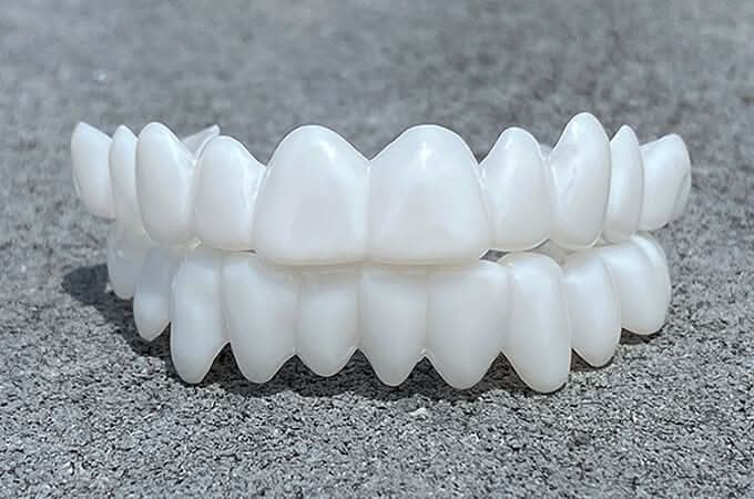 Reusable Dental Prosthesis with White Veneers in Resin for Everyday Wear, view 3