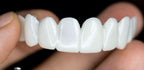 Reusable Dental Prosthesis with White Veneers in Resin for Everyday Wear, view 4
