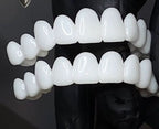 Reusable Dental Prosthesis with White Veneers in Resin for Everyday Wear, view 5