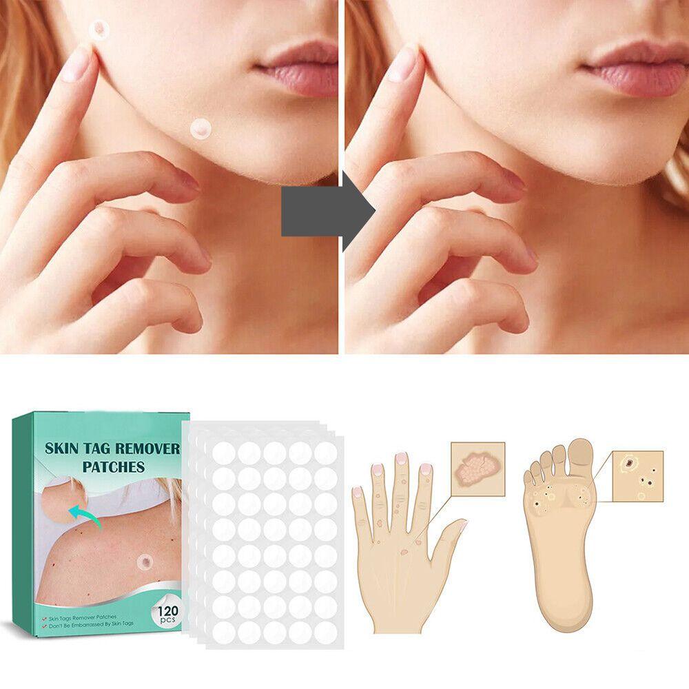 SkinClear Skin Patches for Spots and Warts, 120 Pieces, view 3