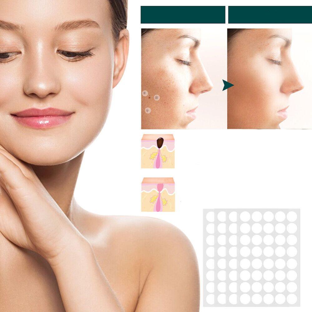SkinClear Skin Patches for Spots and Warts, 120 Pieces, view 4