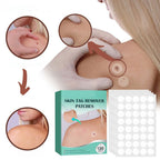 SkinClear Skin Patches for Spots and Warts, 120 Pieces, view 5
