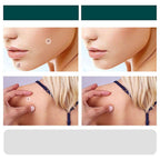 SkinClear Skin Patches for Spots and Warts, 120 Pieces, view 6