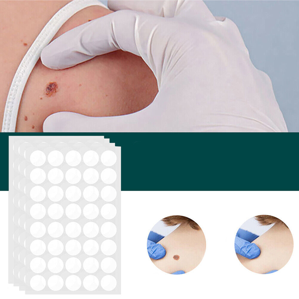 SkinClear Skin Patches for Spots and Warts, 120 Pieces