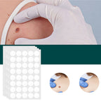 SkinClear Skin Patches for Spots and Warts, 120 Pieces